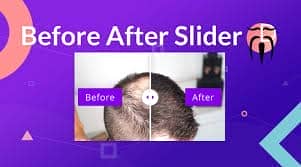 Divi Sensei Before After Slider